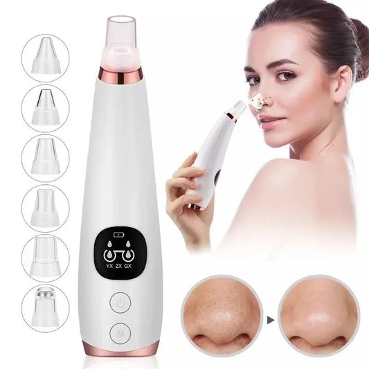 Electric Blackhead Remover Vacuum – Deep Pore Cleaner & Acne Extractor | Facial Skin Care Tool for Blackheads, Oil & Dead Skin